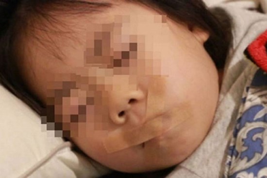 Bà mẹ dán băng dính vào miệng con khi bé ngủ, ai cũng mắng té tát nhưng bác sĩ lại nói rằng cô làm đúng