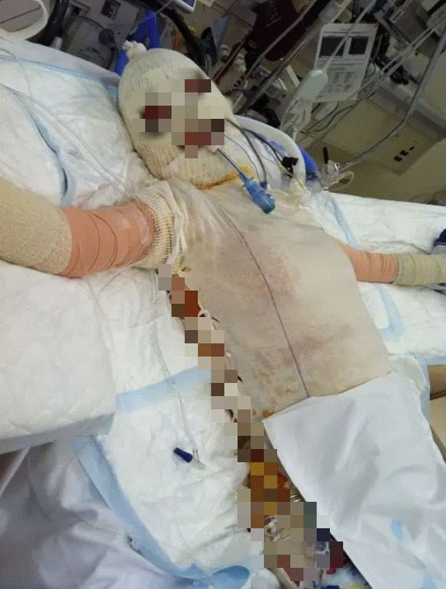 Từng bị đánh ghen đến mức hủy hoại cả dung nhan, 8 năm sau người phụ nữ xuất hiện trở lại khiến kẻ ác phải rùng mình kinh ngạc-2