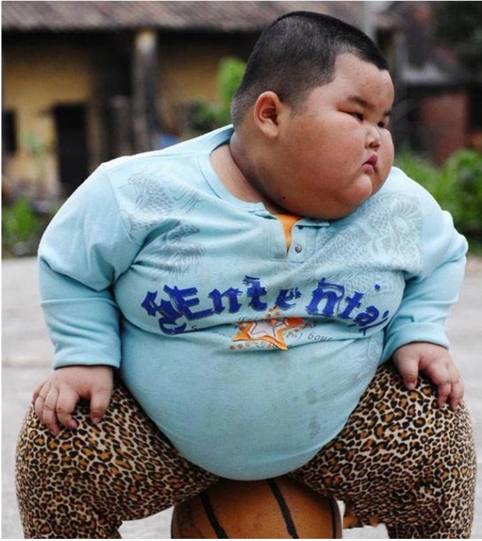 Bé trai 5 tuổi đã nặng 60kg, bị gan nhiễm mỡ nặng, sau khi thăm khám bác sĩ ngán ngẩm vì cách cho ăn của cha mẹ-1