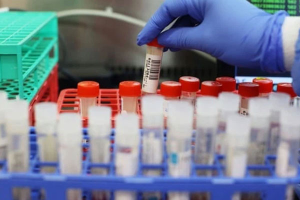 Vì sao ổ dịch tại TP Hải Dương phức tạp hơn Cẩm Giàng?-2