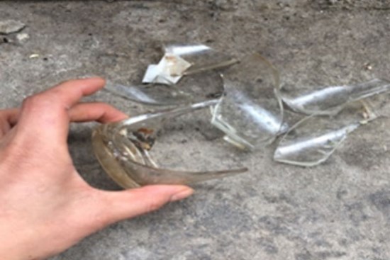 Hà Nội: Bé 16 tháng tuổi bị mảnh vỡ cốc thủy tinh cắm vào bụng