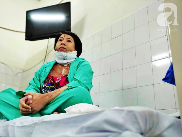 Người phụ nữ trẻ bị chồng tẩm xăng đốt, trải qua 18 ca mổ đau đớn như chết đi sống lại và sự tái sinh nhờ tình mẫu tử thiêng liêng-1