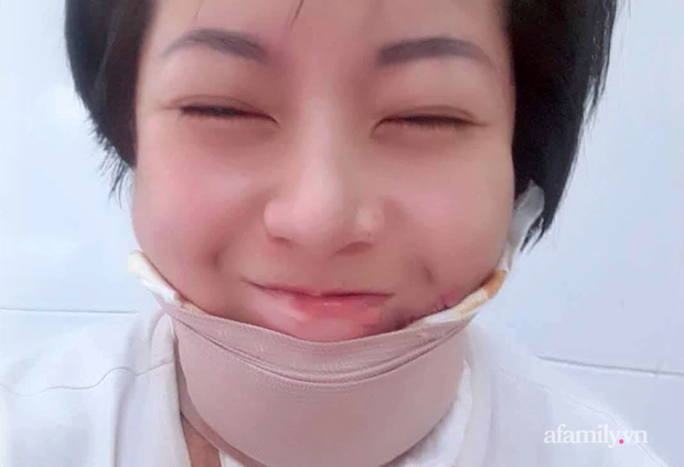 Người phụ nữ trẻ bị chồng tẩm xăng đốt, trải qua 18 ca mổ đau đớn như chết đi sống lại và sự tái sinh nhờ tình mẫu tử thiêng liêng-9