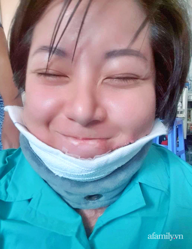 Người phụ nữ trẻ bị chồng tẩm xăng đốt, trải qua 18 ca mổ đau đớn như chết đi sống lại và sự tái sinh nhờ tình mẫu tử thiêng liêng-12