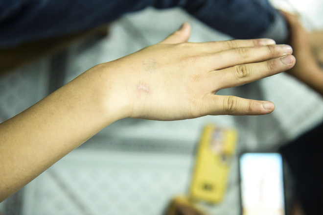 Hà Nội: CA điều tra nghi án bé gái 12 tuổi bị mẹ đẻ trói tay, chân đánh bầm tím khắp cơ thể-4