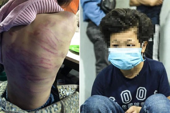 Hà Nội: CA điều tra nghi án bé gái 12 tuổi bị mẹ đẻ trói tay, chân đánh bầm tím khắp cơ thể