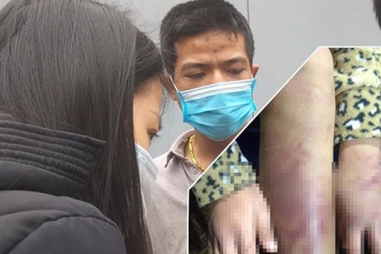 Tâm sự xót xa của bố đẻ bé gái 12 tuổi nghi bị mẹ và người tình bạo hành dã man ở Hà Nội