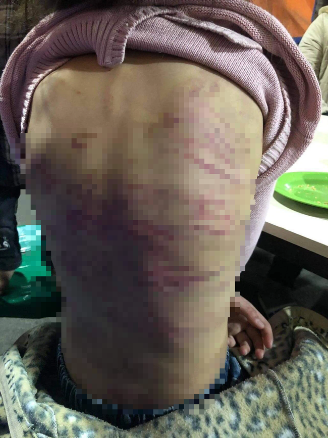 Tâm sự xót xa của bố đẻ bé gái 12 tuổi nghi bị mẹ và người tình bạo hành dã man ở Hà Nội-1