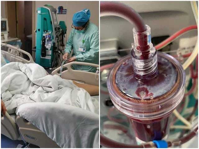 Phải nhập viện cấp cứu sau Tết, bác sĩ nói nữ sinh viên bị viêm tụy cấp do ăn uống kiểu này-3