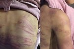 Bé gái 12 tuổi ở Hà Nội bị mẹ và nhân tình bạo hành, xâm hại: Khi xảy ra mới can thiệp thì đã muộn-5