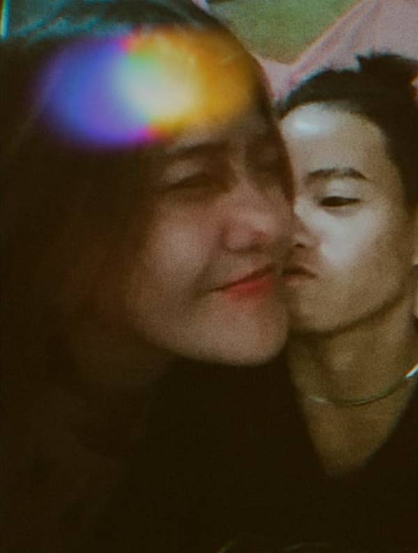 Cô bé người sói với khuôn mặt nhiều lông lá nhất thế giới sau hơn 10 năm xuất hiện trở lại với vẻ ngoài cùng cuộc sống gây kinh ngạc-5