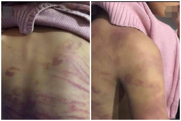 Phẫn nộ trước lời khai rùng rợn của kẻ bạo hành, hiếp dâm bé gái 12 tuổi ở Hà Nội-2