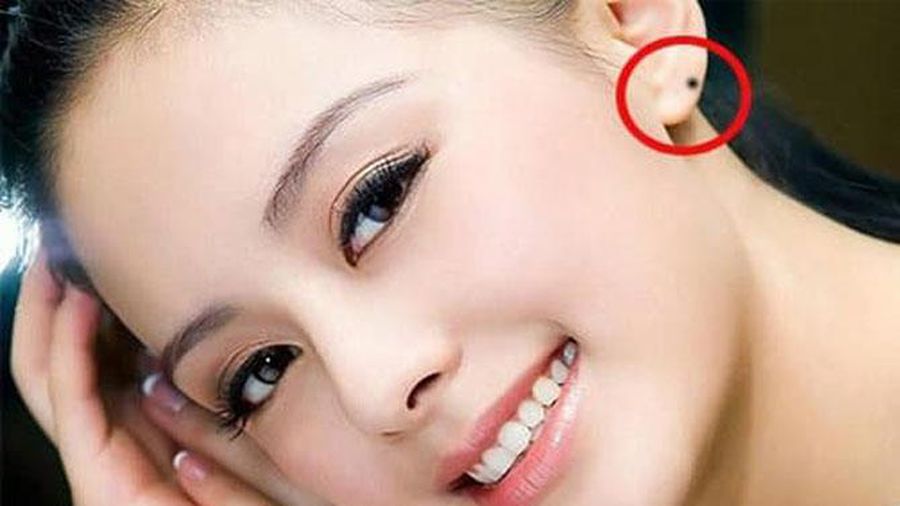 Nốt ruồi ở tai nói trước tương lai của bạn?-2