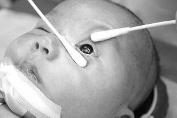 Thấy con thích lè lưỡi mẹ tưởng bình thường đến khi bác sĩ chỉ ra bệnh lý nguy hiểm gia đình mới tá hỏa đi chạy chữa-7