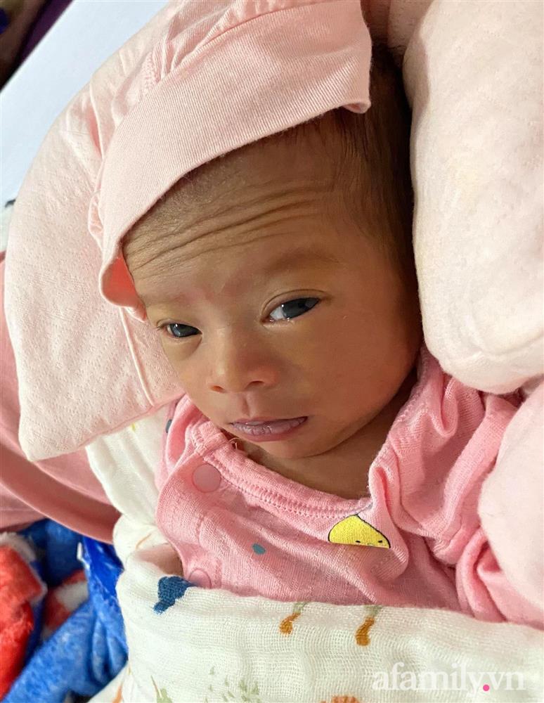 Bé gái Kiên Giang sinh non gầy guộc, da đen nhẻm, nhăn nheo như chú khỉ con, nhưng chỉ hơn 2 tháng sau nhìn bé ai cũng ngỡ ngàng-2