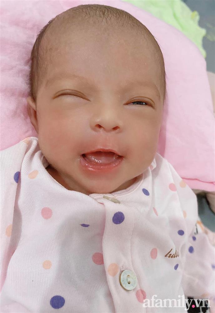 Bé gái Kiên Giang sinh non gầy guộc, da đen nhẻm, nhăn nheo như chú khỉ con, nhưng chỉ hơn 2 tháng sau nhìn bé ai cũng ngỡ ngàng-3