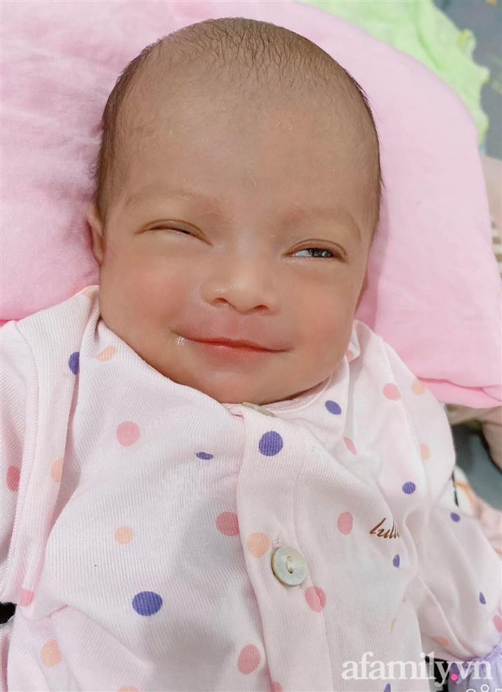 Bé gái Kiên Giang sinh non gầy guộc, da đen nhẻm, nhăn nheo như chú khỉ con, nhưng chỉ hơn 2 tháng sau nhìn bé ai cũng ngỡ ngàng-4