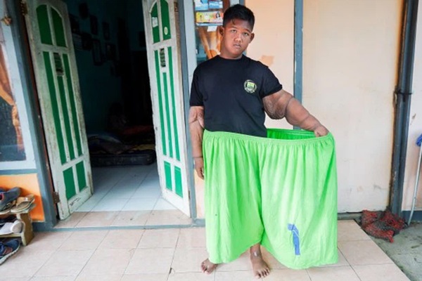 Cậu bé béo nhất thế giới nặng gần 200kg gây choáng với ngoại hình mới chỉ sau 4 năm giảm cân, nhìn hình không ai dám tin là cùng một người-10