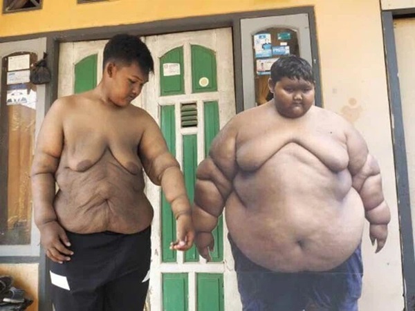 Cậu bé béo nhất thế giới nặng gần 200kg gây choáng với ngoại hình mới chỉ sau 4 năm giảm cân, nhìn hình không ai dám tin là cùng một người-9