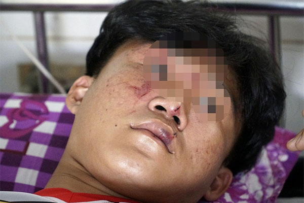 Diễn biến mới vụ người lạ vào tận trường lôi học sinh ra ngoài đánh-3