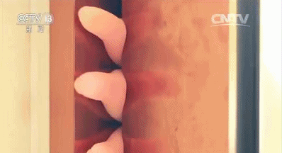 Cậu bé 3 tuổi suýt bị thiệt mạng do kẹp vào cửa, đừng để sự giải cứu sai lầm của bố mẹ làm tổn thương con-6