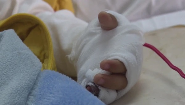 Cậu bé 3 tuổi suýt bị thiệt mạng do kẹp vào cửa, đừng để sự giải cứu sai lầm của bố mẹ làm tổn thương con-1