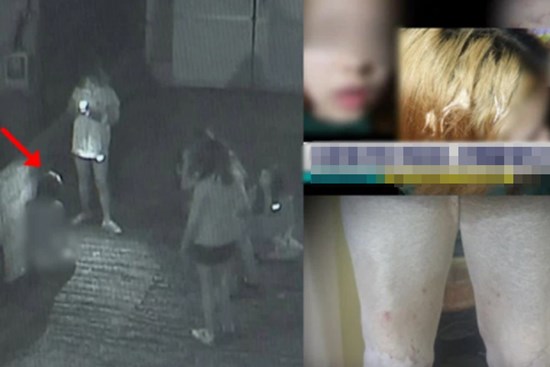 Nữ sinh 15 tuổi bị bạn cùng trường hành hung đến thân tàn ma dại chỉ bởi vì xuất thân khác biệt của mẹ ruột