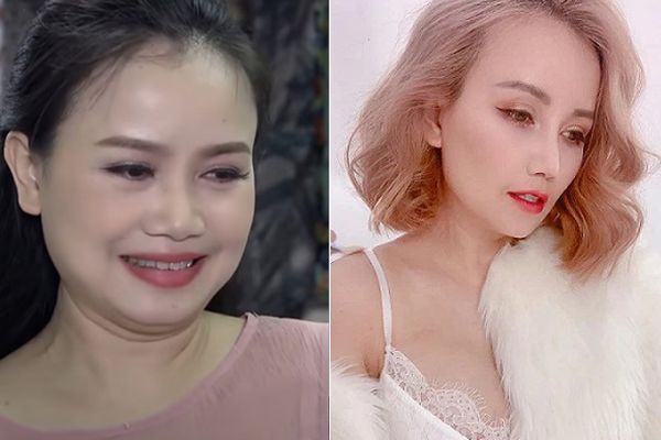 Chi hơn 2 tỷ phẫu thuật thẩm mỹ, 9X nhận cái kết đắng-6