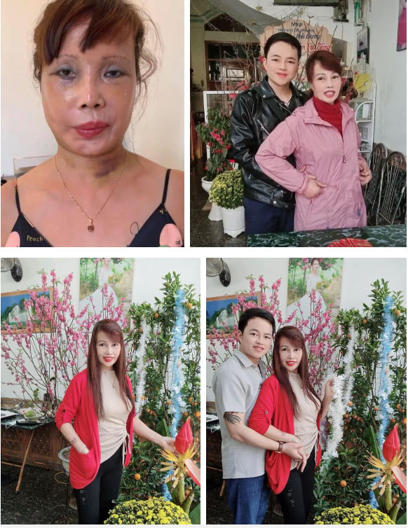 Vừa khoe gương mặt đã khỏi bị lệch, cô dâu Cao Bằng 64 tuổi lại hé lộ hình ảnh cho thấy mối quan hệ của chồng phi công với con gái riêng của vợ-3