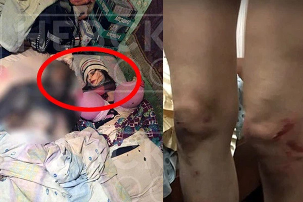 Bé gái 9 tuổi bị cha dượng biến thành nô lệ tình dục bằng các hành vi bệnh hoạn, tình trạng hiện tại của nạn nhân thật xót xa-3