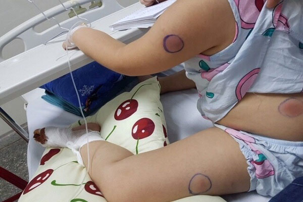 Thêm trường hợp quý ông gặp tai nạn gãy dương vật, bác sĩ lên tiếng cảnh báo-2