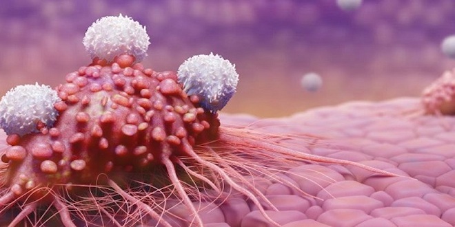 Nếu đau vai gáy đi kèm với những dấu hiệu kỳ lạ này, bạn cần đi khám lập tức 3 loại ung thư nguy hiểm-1