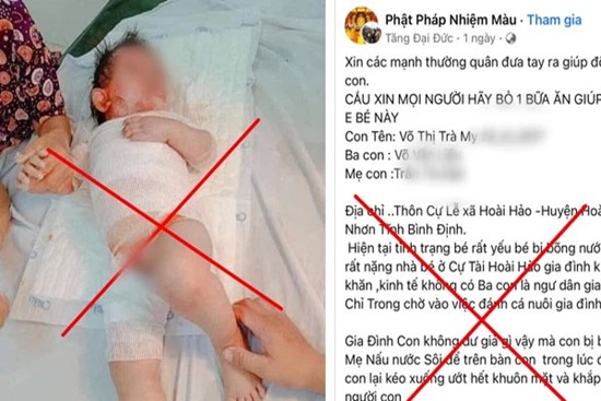 Kẻ xấu lấy hình ảnh bé gái bị bỏng 2 năm trước để kiếm tiền trên lòng tốt của người khác