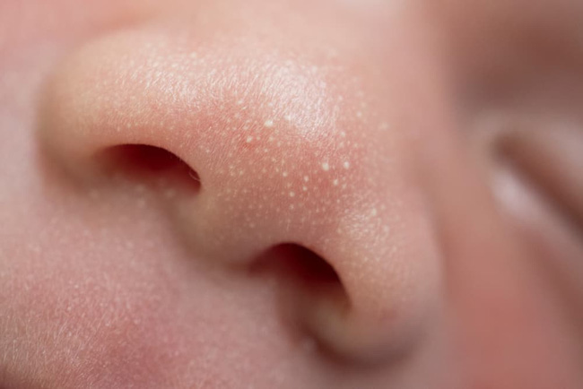 Từ dấu hiệu mà Hồ Ngọc Hà chia sẻ, bé Lisa có thể đang gặp một trong những bệnh lý này, phụ huynh có con nhỏ cũng cần lưu ý-4