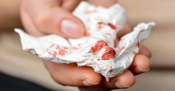 5 vị trí cơ thể này nếu bất ngờ chảy máu thì coi chừng bạn đã mắc ung thư từ lâu mà không biết-3