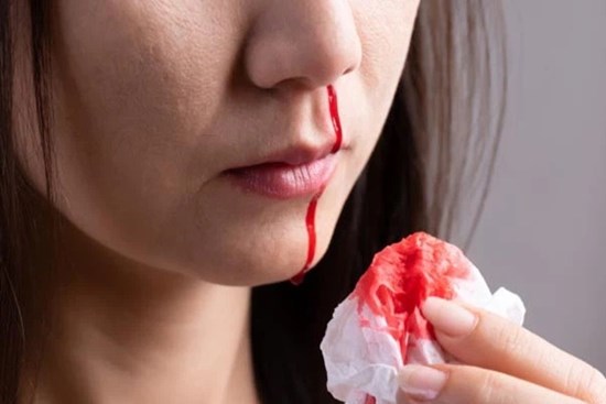 5 vị trí cơ thể này nếu bất ngờ chảy máu thì coi chừng bạn đã mắc ung thư từ lâu mà không biết