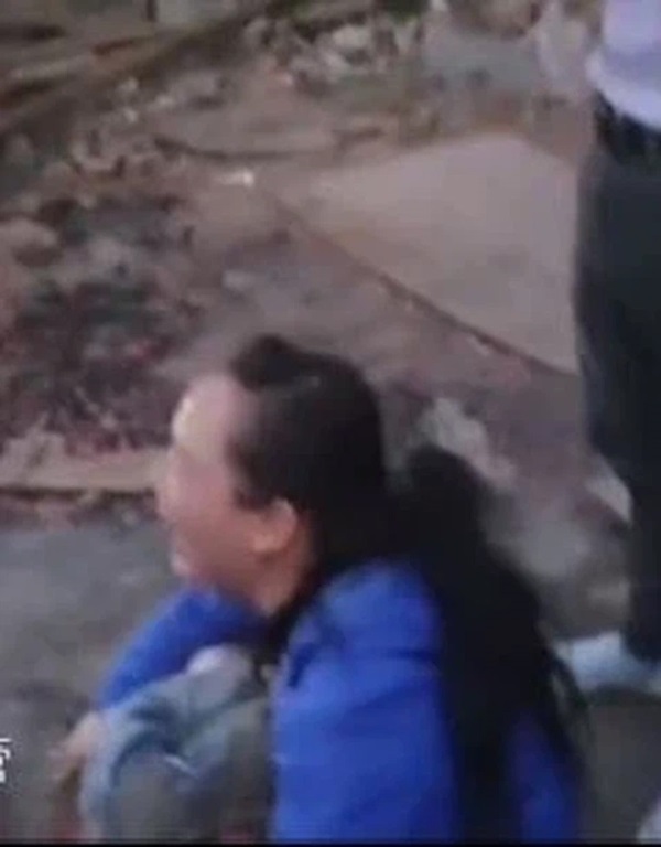 Bé gái 4 tuổi ngã vào máy trộn xi măng nguy kịch, hình ảnh nạn nhân ở hiện trường khiến người nhà đau lòng tột độ-2