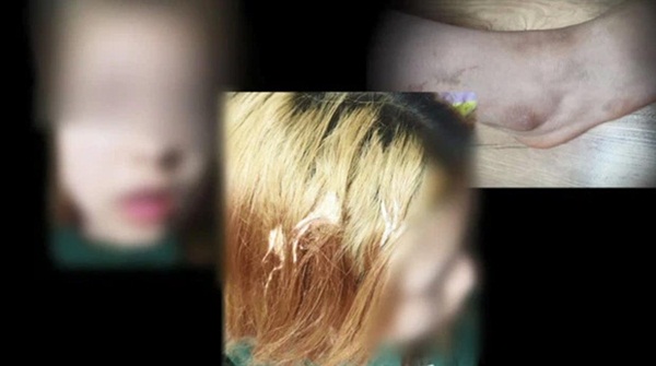 Vụ bắt nạt gây xôn xao: Nữ sinh bị đánh đập tàn bạo, đổ cà phê vào mặt, biết lý do mà ai cũng thương xót-1