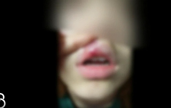 Vụ bắt nạt gây xôn xao: Nữ sinh bị đánh đập tàn bạo, đổ cà phê vào mặt, biết lý do mà ai cũng thương xót-3