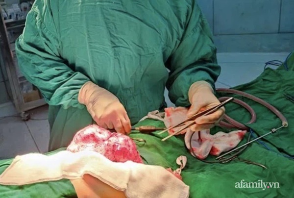 Bé trai 6 tuổi thủng ruột suýt chết do nuốt phải nam châm-2