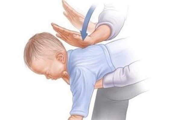Dân mạng thi nhau chia sẻ phương pháp Heimlich cứu em bé hóc dị vật, nhưng liệu có thực sự hiệu quả với trẻ nhỏ?-2