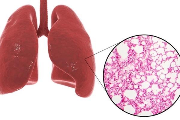 5 thực phẩm là máy lọc thận giúp cơ thể bài độc sạch sẽ, phụ nữ siêng ăn còn ngừa mụn và nuôi dưỡng làn da-6