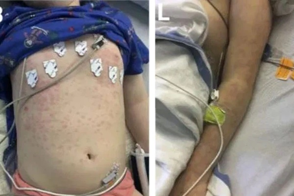 Sáng 3/3, có 3 ca mắc COVID-19 ở Bình Dương và Kiên Giang-2