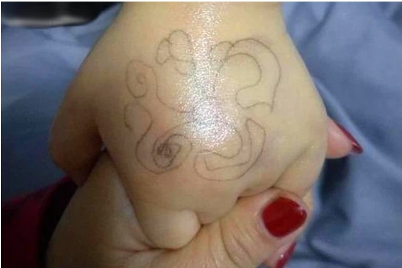 Con gái mừng rỡ khi được giáo viên vẽ ký hiệu lạ trên tay, nhưng vừa nhìn thấy bà mẹ lập tức báo cảnh sát-1