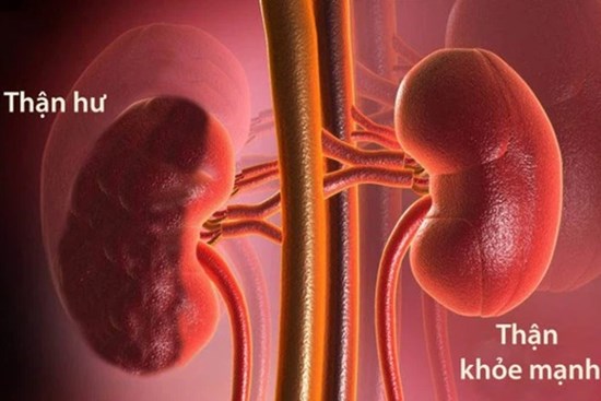 Người thận yếu thường có 6 đặc điểm rất dễ nhận biết: Hãy sớm đi khám nếu bạn có cảm giác tương tự