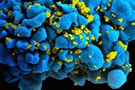 Phát hiện mới về nhóm người tự khỏi HIV không cần dùng thuốc