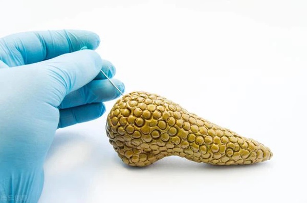 Nếu thấy 3 triệu chứng xuất hiện ở bụng, 1 ở lưng, hãy kiểm tra ung thư kịp thời-5