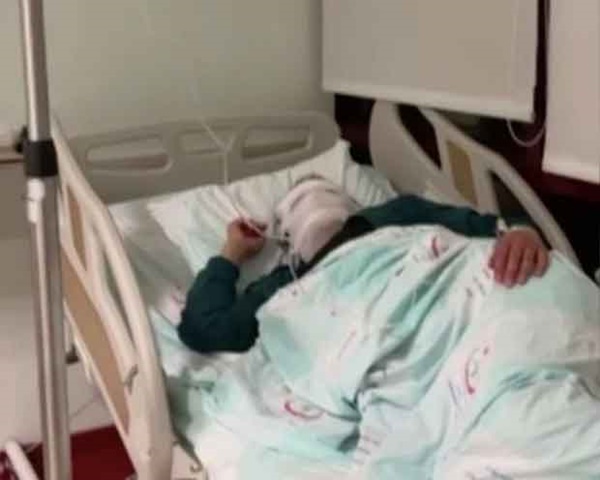 Đang từ xinh đẹp, người phụ nữ bỗng bị chảy mủ, sưng tấy khắp mặt vô cùng kinh hãi chỉ vì việc làm quen thuộc của rất nhiều chị em-3