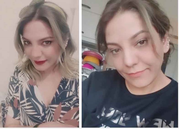 Đang từ xinh đẹp, người phụ nữ bỗng bị chảy mủ, sưng tấy khắp mặt vô cùng kinh hãi chỉ vì việc làm quen thuộc của rất nhiều chị em-4