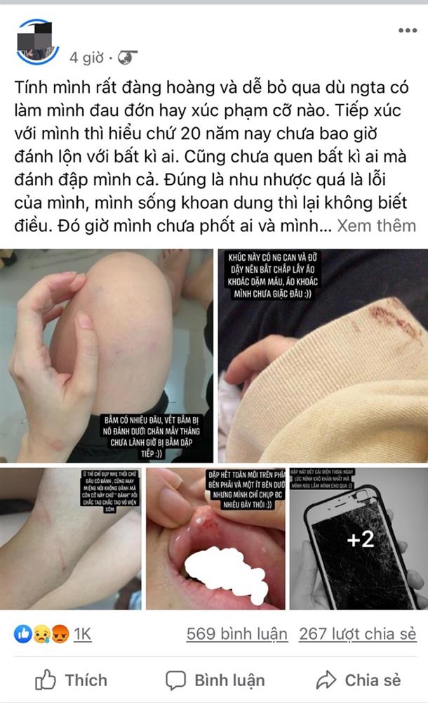 Phát hiện trai lạ thả tim ảnh bạn gái, nam thanh niên ra tay đánh đập người yêu đến bầm dập-1